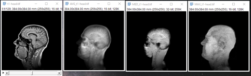 t1 head different z projections