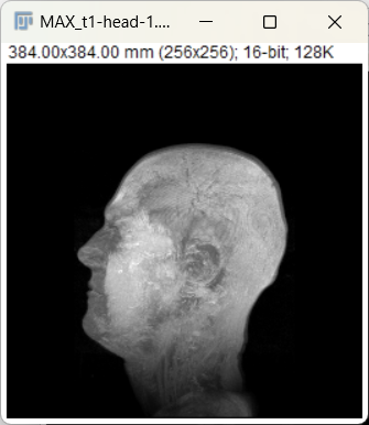 t1 head max z projection